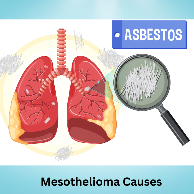 Mesothelioma Causes